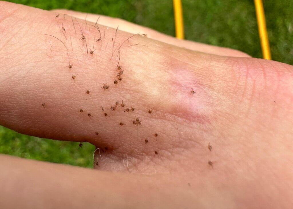 Tick Control Oyster Bay, NY